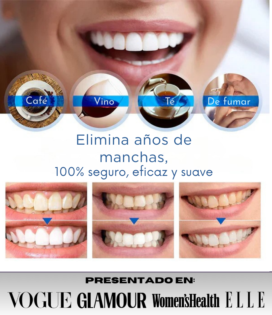 GlowDent® - Blanqueador Dental de Alta Eficacia