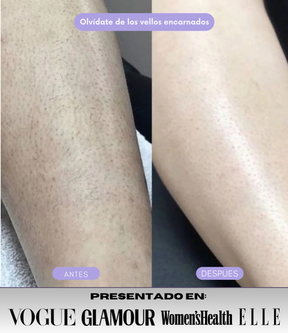 GlassySkin® / OFERTA LIMITADA + CREMA REPARADORA CC CREAM (GRATIS)
