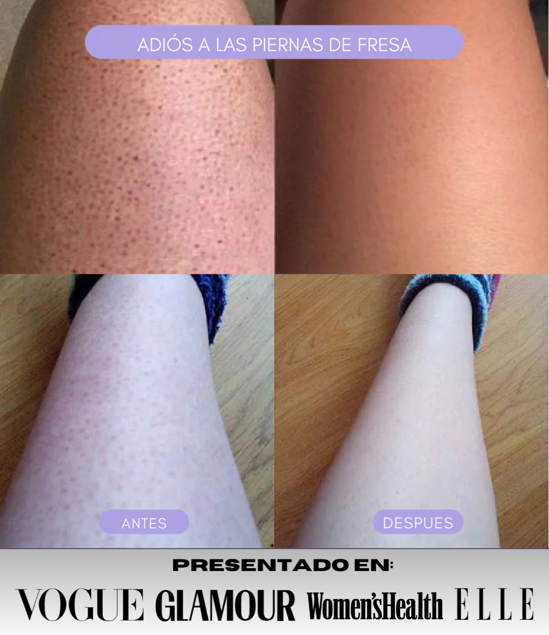 GlassySkin® / OFERTA LIMITADA + CREMA REPARADORA CC CREAM (GRATIS)