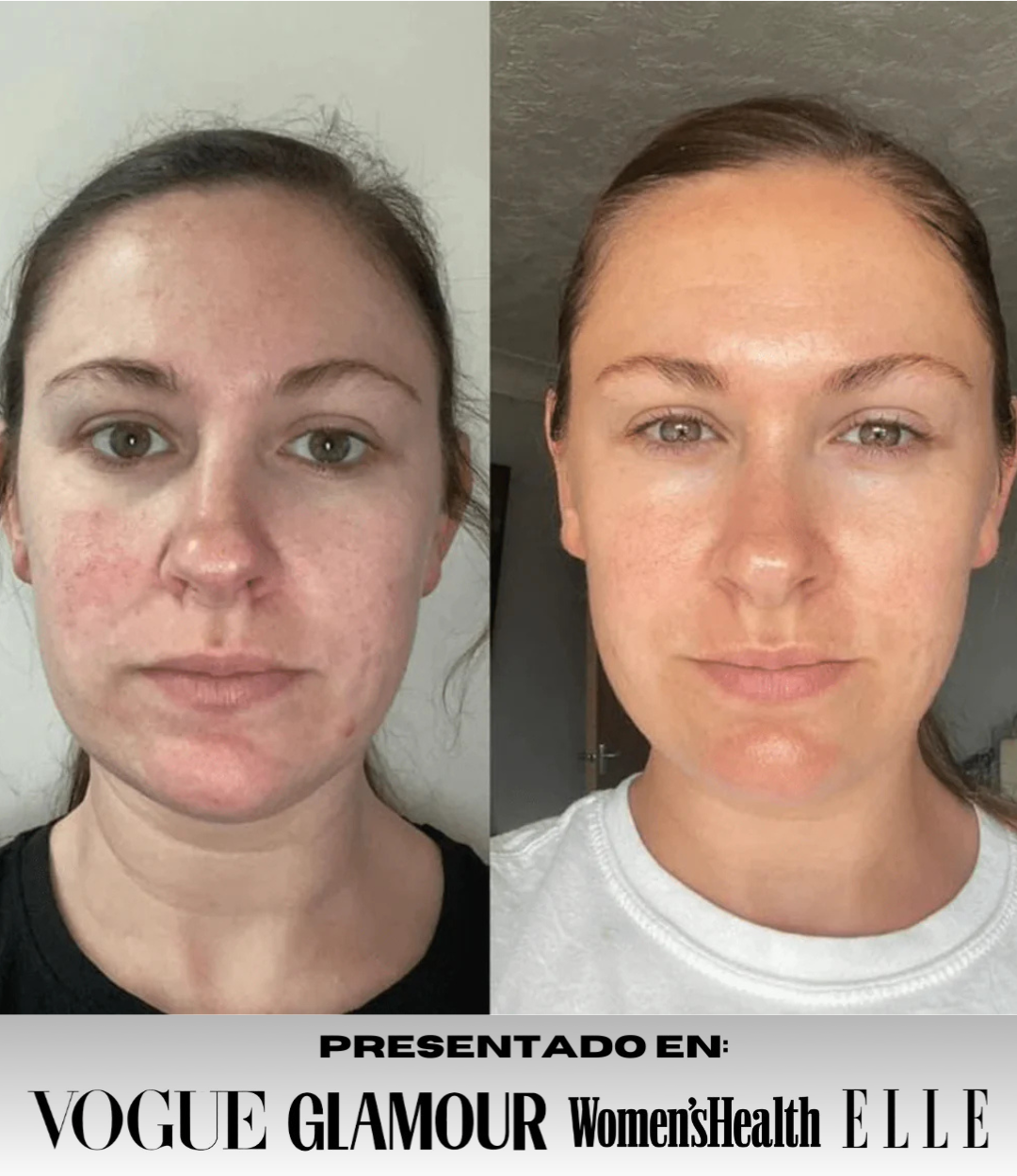 Oferta 5 Mascarillas de colágeno profundo SkinRevié® + Sérum ojos GRATIS
