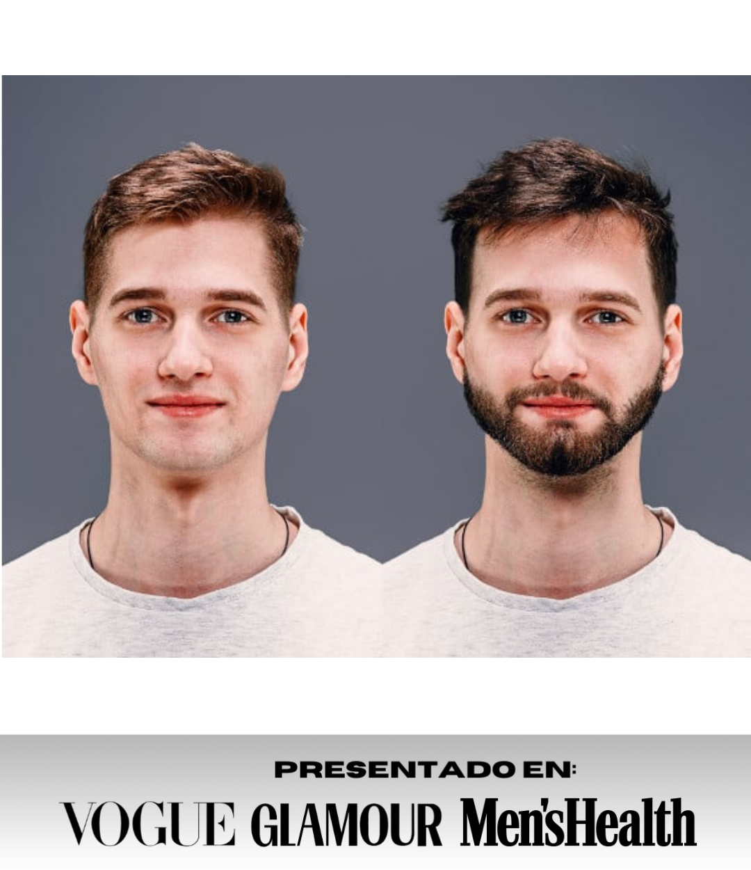 IRONBEARD® - Sérum Crece Barba + Regalo