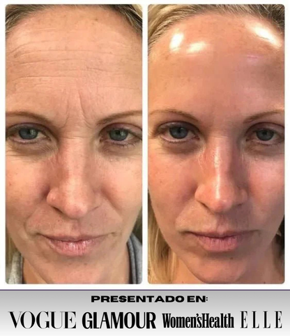 Oferta 5 Mascarillas de colágeno profundo SkinRevié® + Sérum ojos GRATIS