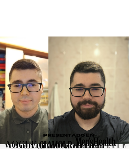 IRONBEARD® - Sérum Crece Barba + Regalo