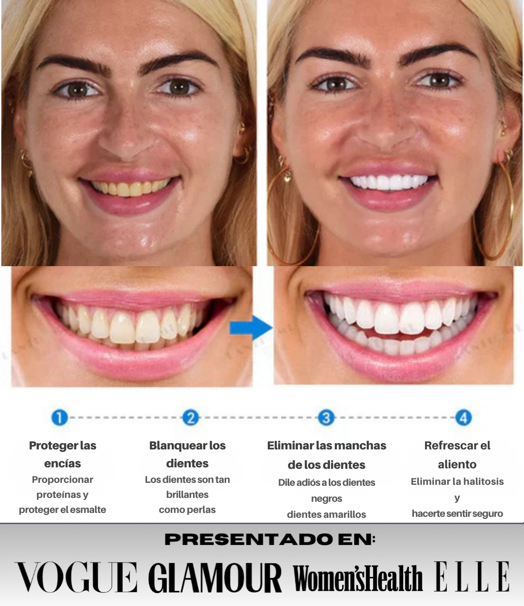 GlowDent® - Blanqueador Dental de Alta Eficacia