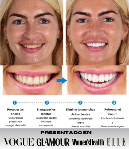 GlowDent® - Blanqueador Dental de Alta Eficacia