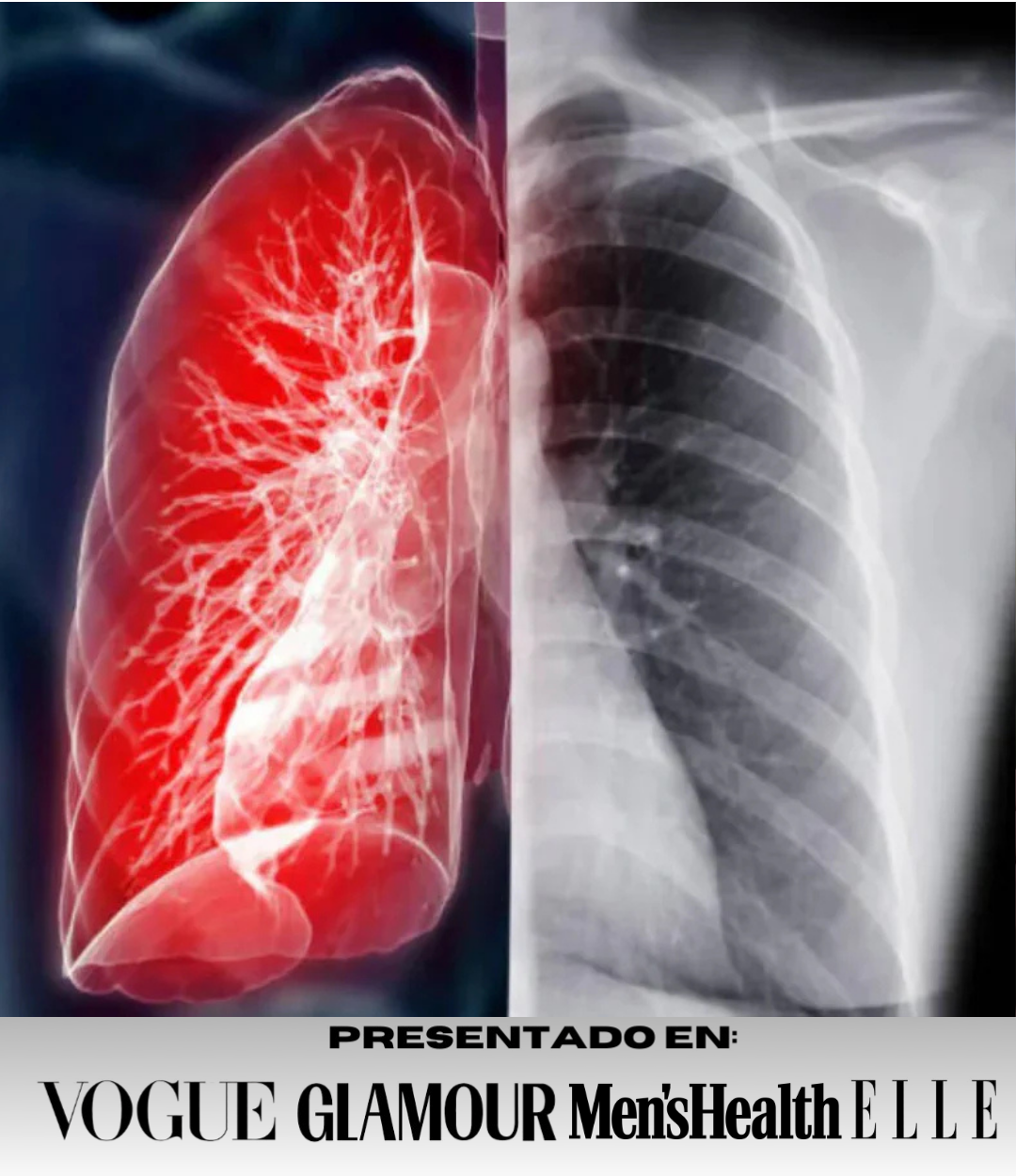 Entrenador Pulmonar OxyPro® + Regalo