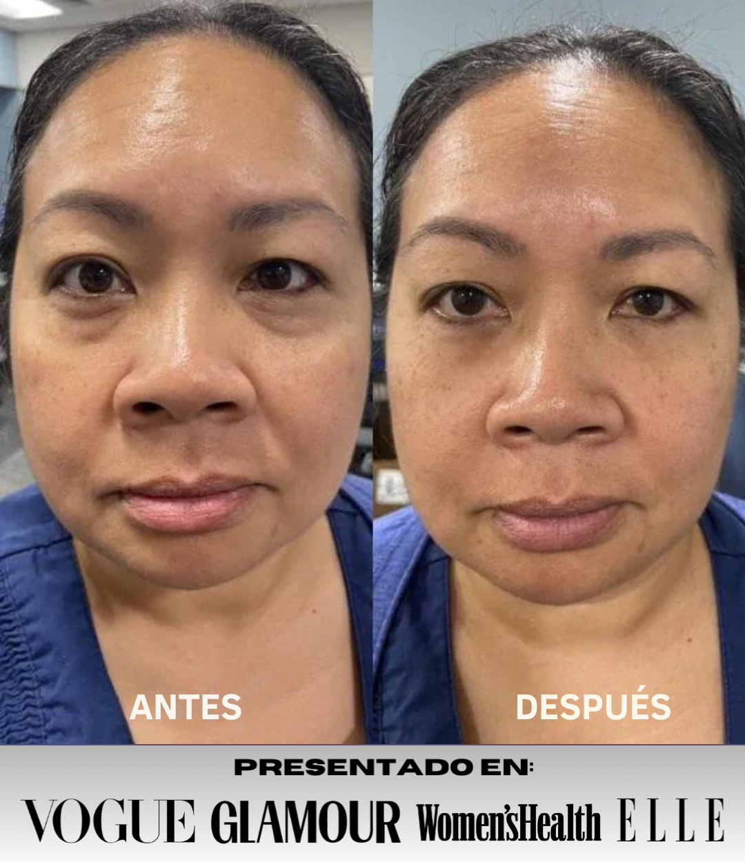 Mascarilla Collageno Reafirmante de Ojos InstantLift® + REGALO
