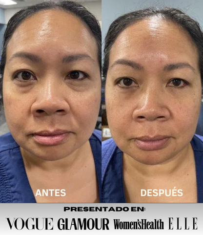 Mascarilla Collageno Reafirmante de Ojos InstantLift® + REGALO