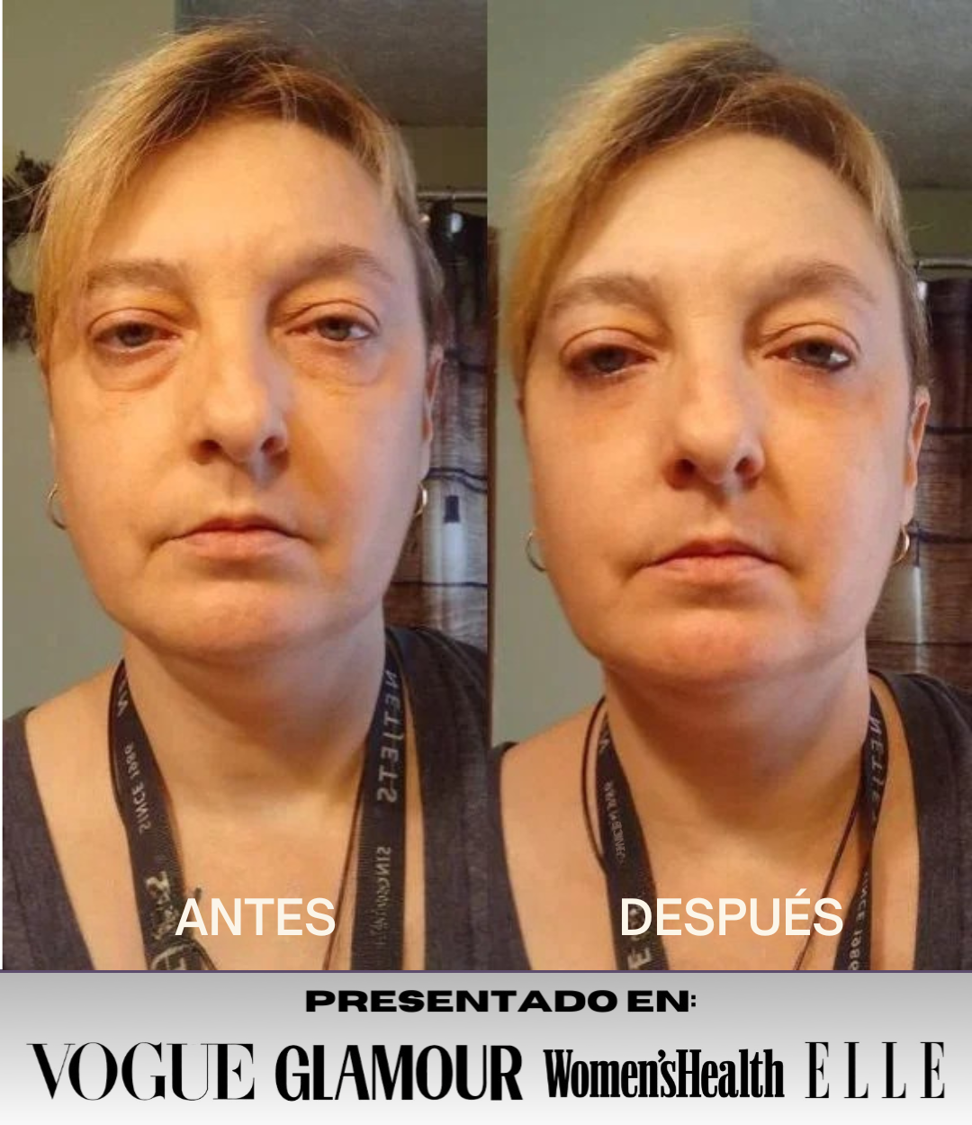 Mascarilla Collageno Reafirmante de Ojos InstantLift® + REGALO
