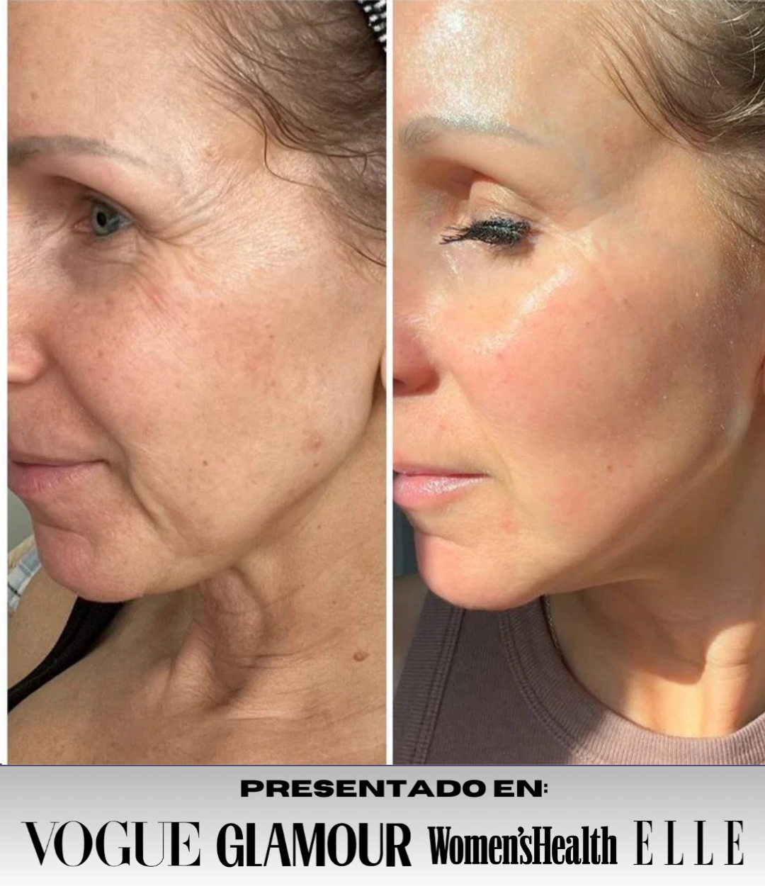 Oferta 5 Mascarillas de colágeno profundo SkinRevié® + Sérum ojos GRATIS